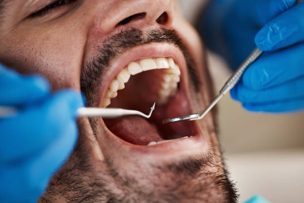 Best Emergency Tooth Extraction in Curtice, OH